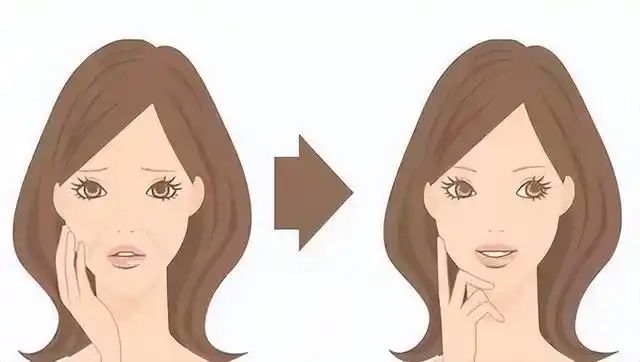 较合适？可以保持几年恢复期消除法令纹医院pg电子免费模拟器游戏拉皮手术怎么找比