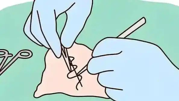 吗？术后效果案例对比图医生推荐医院pg电子模拟器试玩面部做大拉皮靠谱(图1)